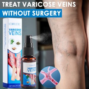 30ml Varicose Vein Spray Multi-Purpose Knee And Leg Care Spray Promote Blood Circulation
